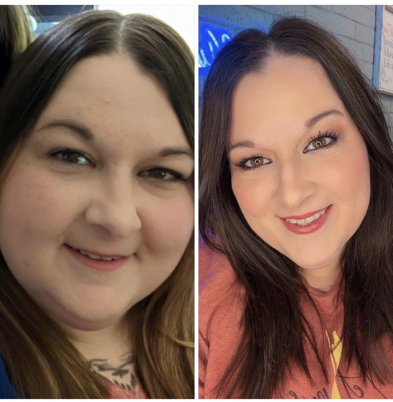 Mandy before and after losing 116 pounds with Emerge Weight Loss