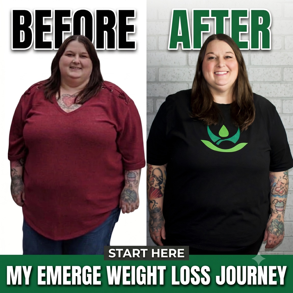 Full-body before and after photo of Mandy's Emerge Weight Loss journey